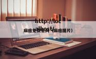 麻痘免费官网（麻痘图片）